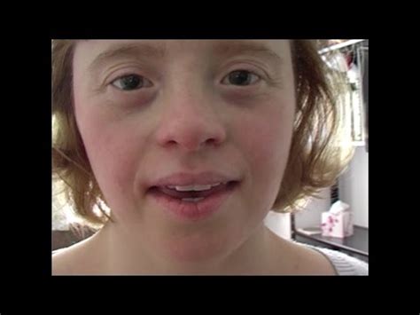 sexy retard|Girl with down's syndrome's home video goes wrong (Wait until.